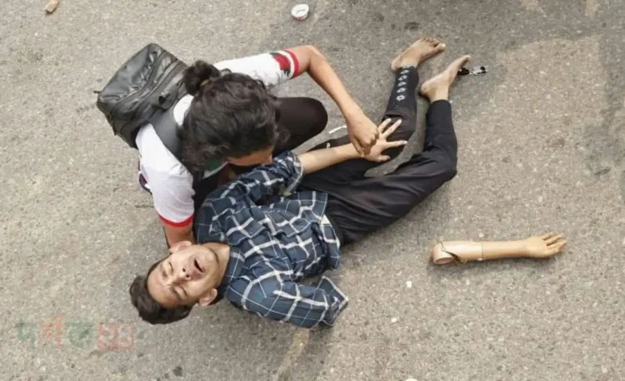 july sonod attoho joddha attacked artificial hand